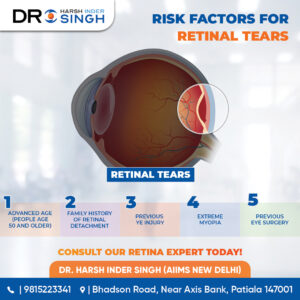 Common Types of Eye Trauma and How They Affect Your Retina