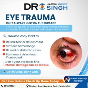 Common Eye Trauma Injuries