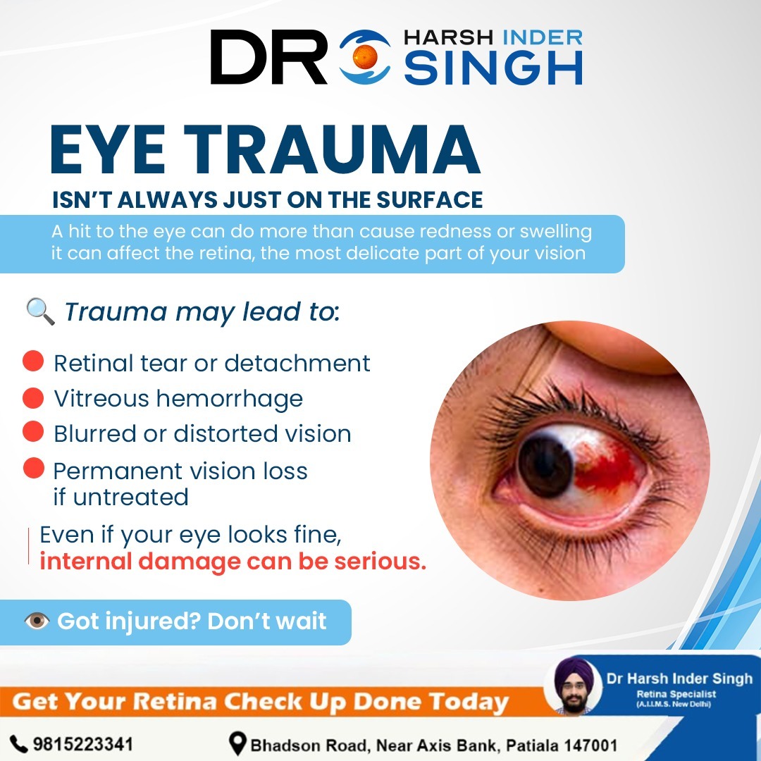 Common Eye Trauma Injuries
