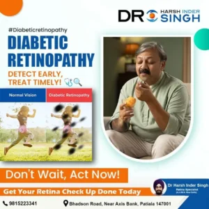 Green Laser Eye Treatment How It Helps in Diabetic Retinopathy