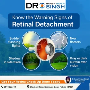 Retinal Detachment Surgery in India
