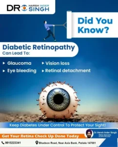 Diabetic Retinopathy Treatment in India