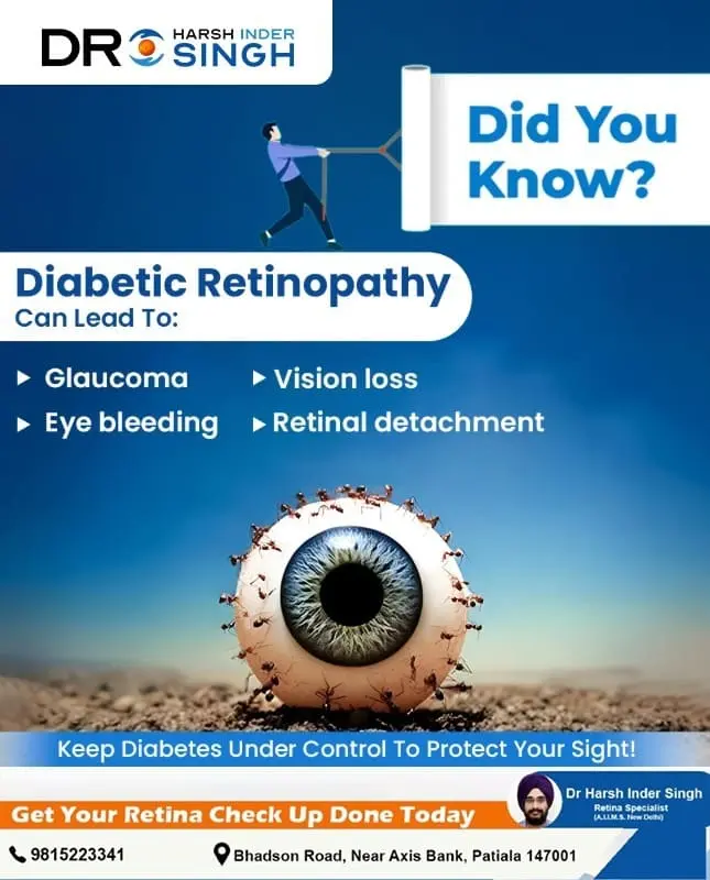Diabetic Retinopathy Treatment in India