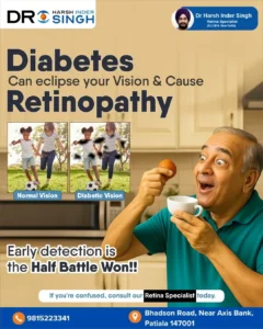 Stages of Diabetic Retinopathy